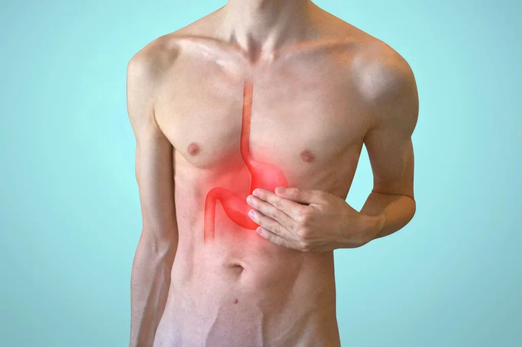 heartburn