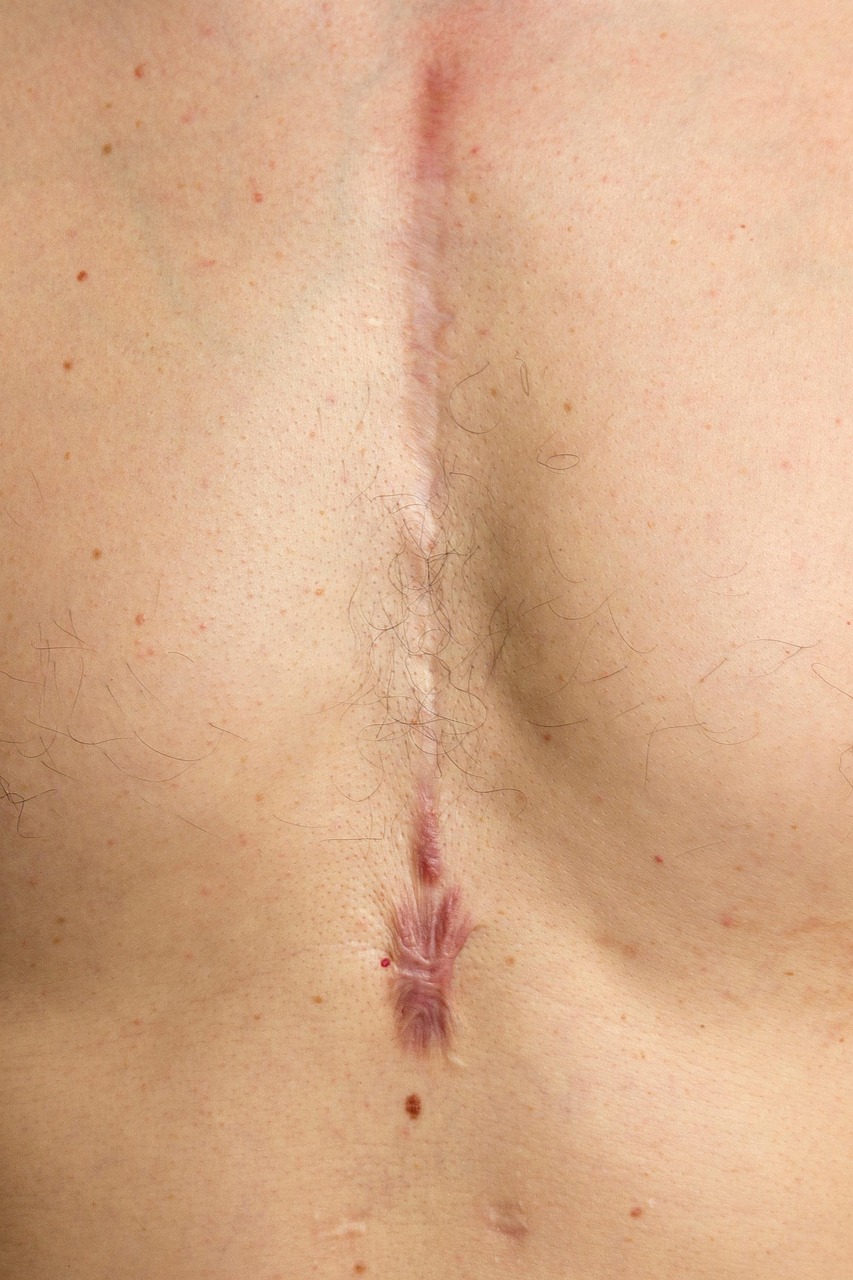 scar