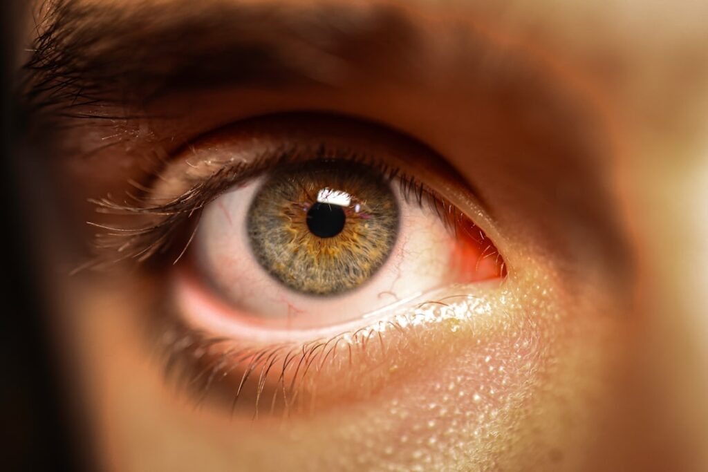 Close-up of a human eye with green and brown iris.