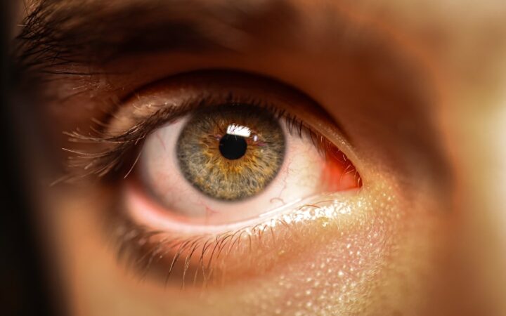 Close-up of a human eye with green and brown iris.